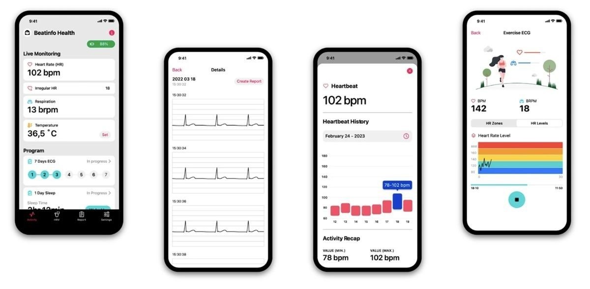 beatinfo-cgm-2.jpg beatinfo-cgm-2.jpg