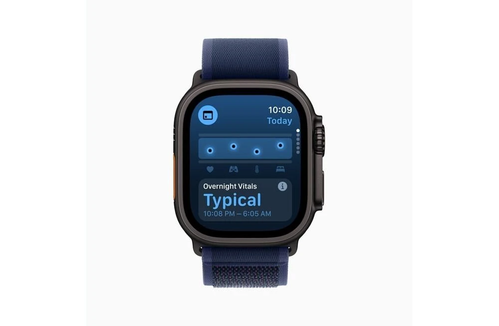 watchos11-vitals.jpg watchos11-vitals.jpg