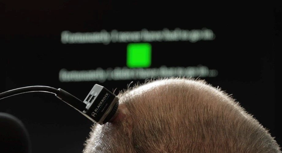 brain-implant-als.jpg brain-implant-als.jpg