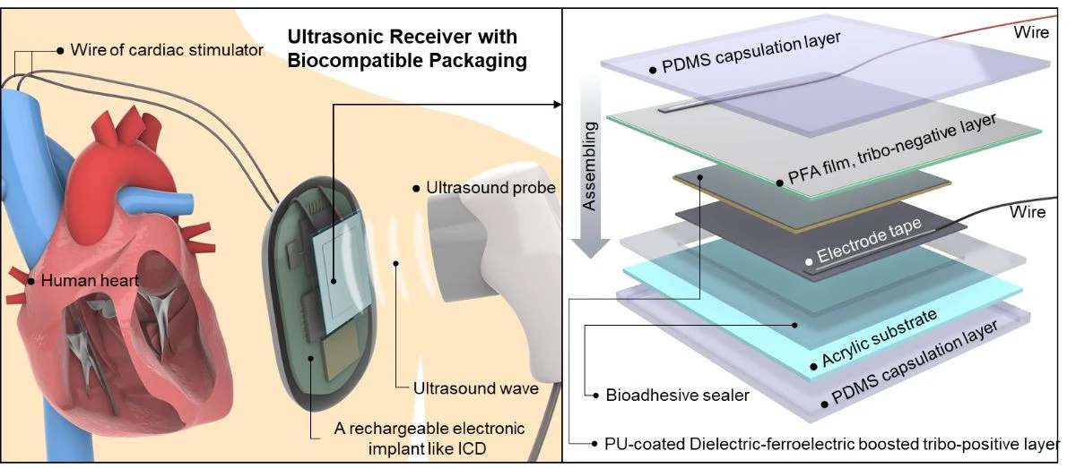 ultrasound-charging.jpg ultrasound-charging.jpg