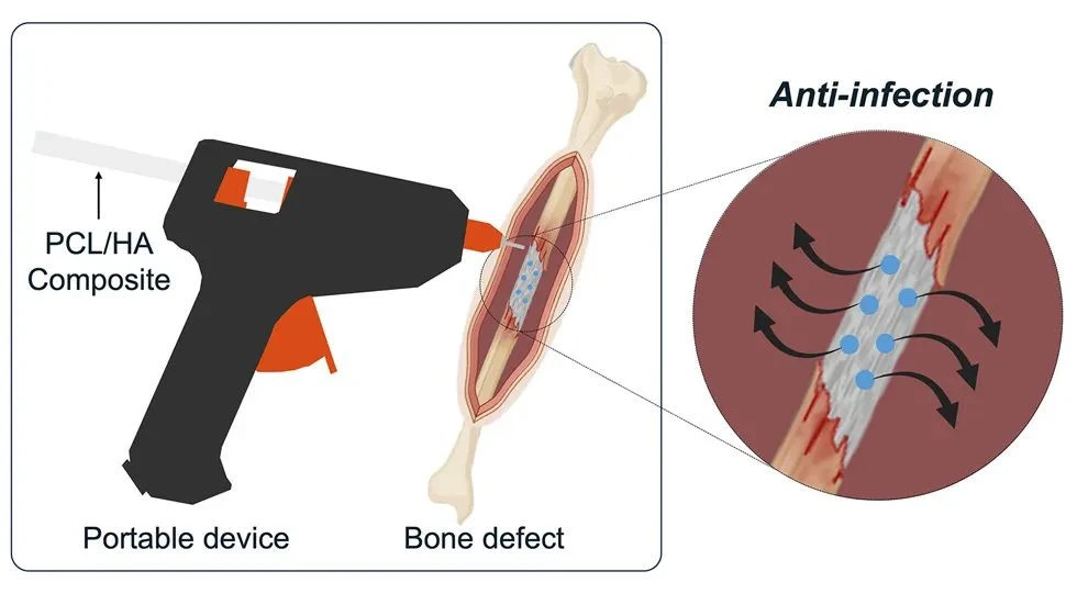 3d-glue-gun-bone.jpg 3d-glue-gun-bone.jpg