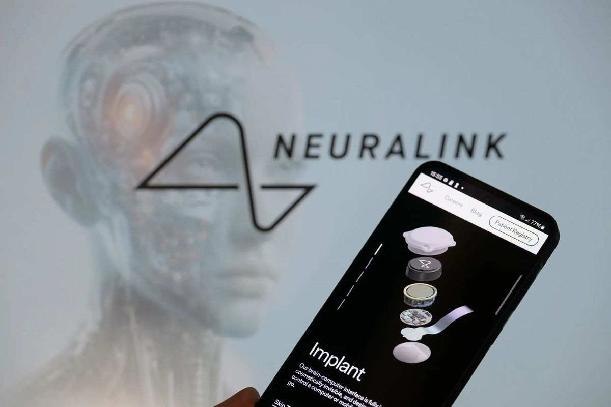 Άκυρο στη Neuralink του Elon Musk για την κατοχύρωση των ονομάτων Telepathy και Telekinesis Άκυρο στη Neuralink του Elon Musk για την κατοχύρωση των ονομάτων Telepathy και Telekinesis