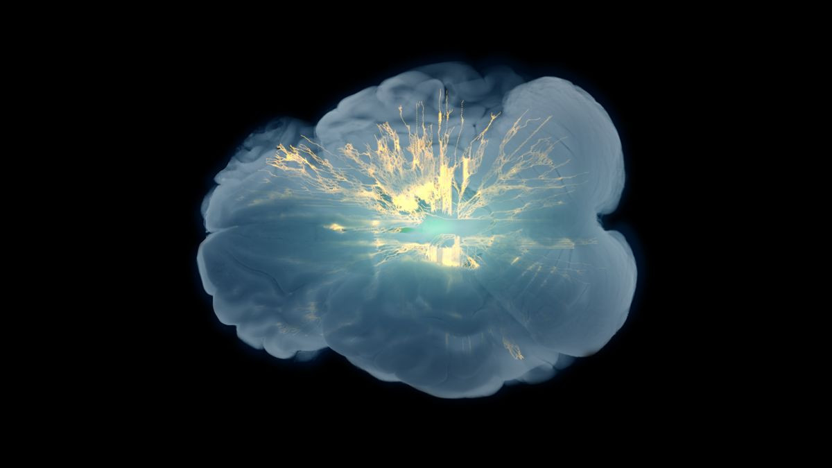 Ο «κρυμμένος» ρυθμός του εγκεφάλου θα μπορούσε να αλλάξει τη θεραπεία του Parkinson Ο «κρυμμένος» ρυθμός του εγκεφάλου θα μπορούσε να αλλάξει τη θεραπεία του Parkinson