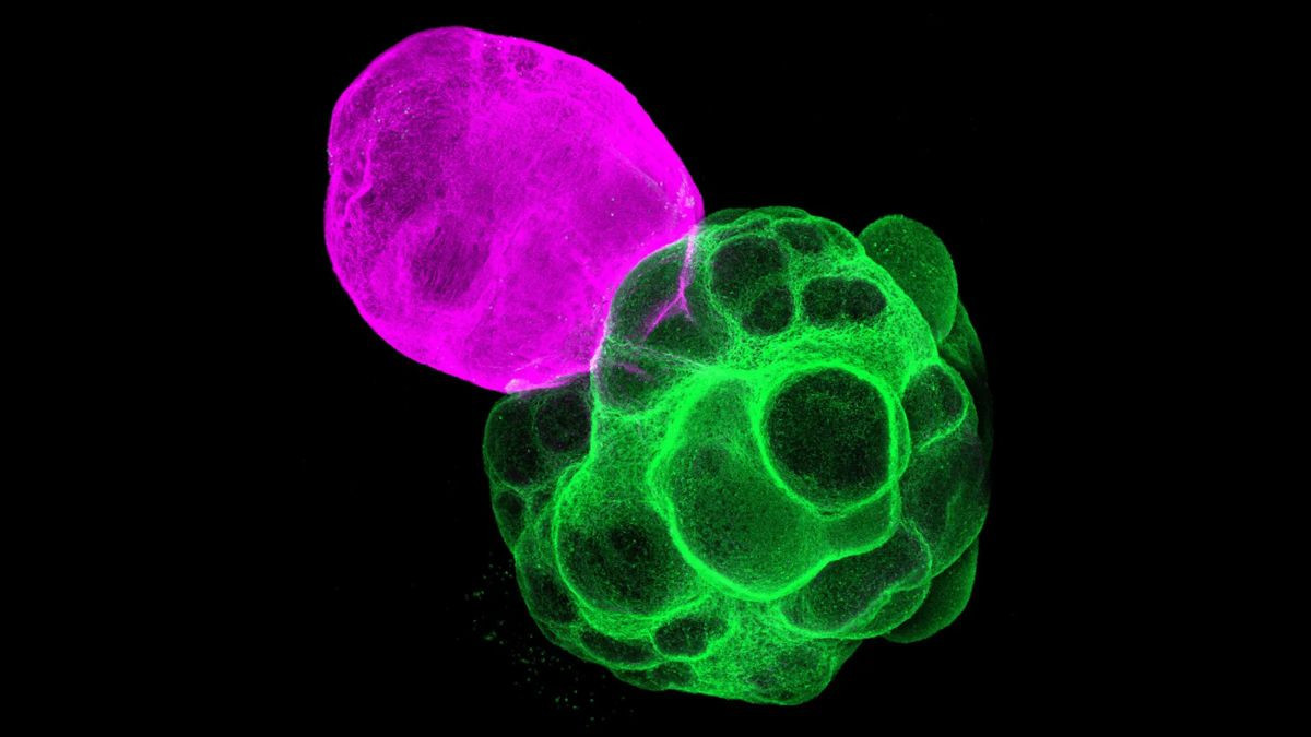 Ιάπωνες ερευνητές δημιούργησαν τεχνητά ανθρώπινα εγκεφαλικά κυκλώματα στο εργαστήριο