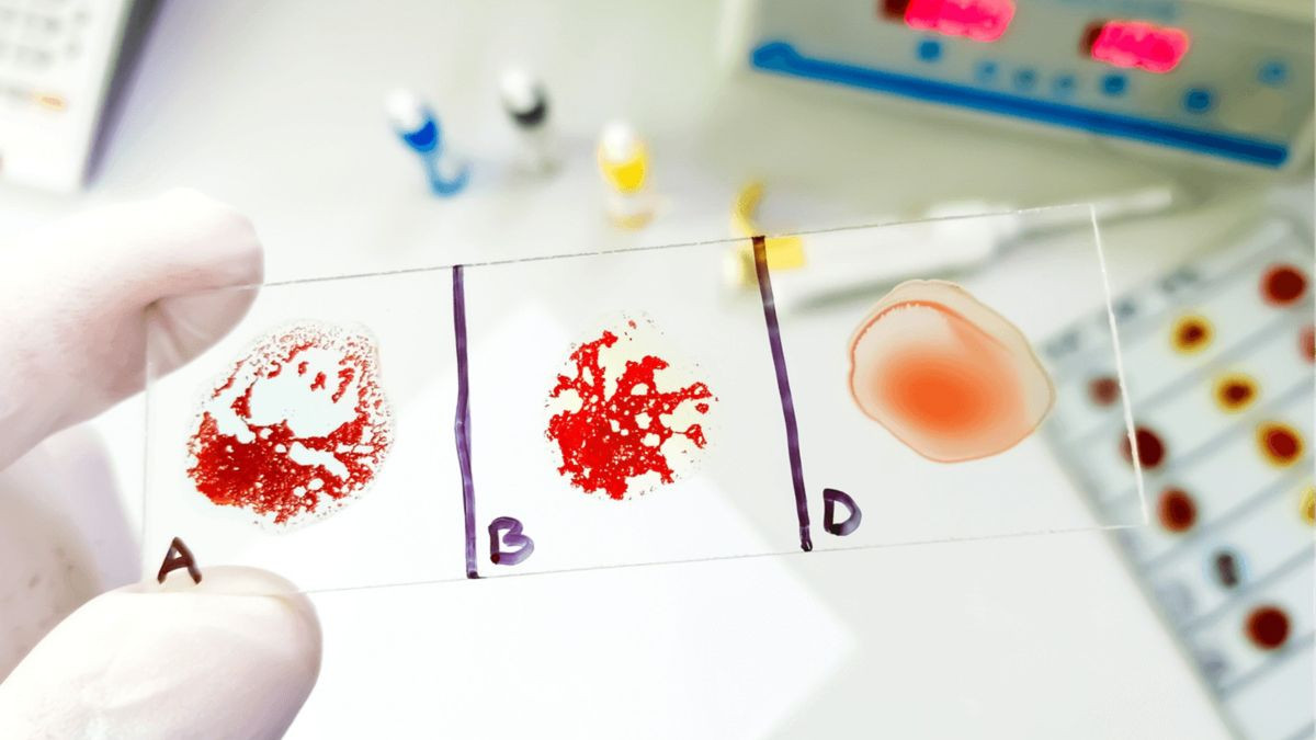 Σπάνια «υβριδική» ομάδα αίματος: Μόλις σε 3 άτομα ανά μισό εκατομμύριο