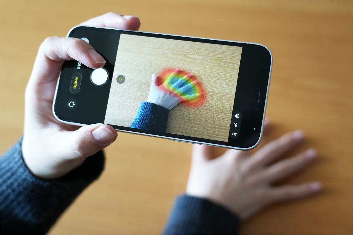 AI μοντέλο ανιχνεύει την ακρομεγαλία από φωτογραφίες χεριών