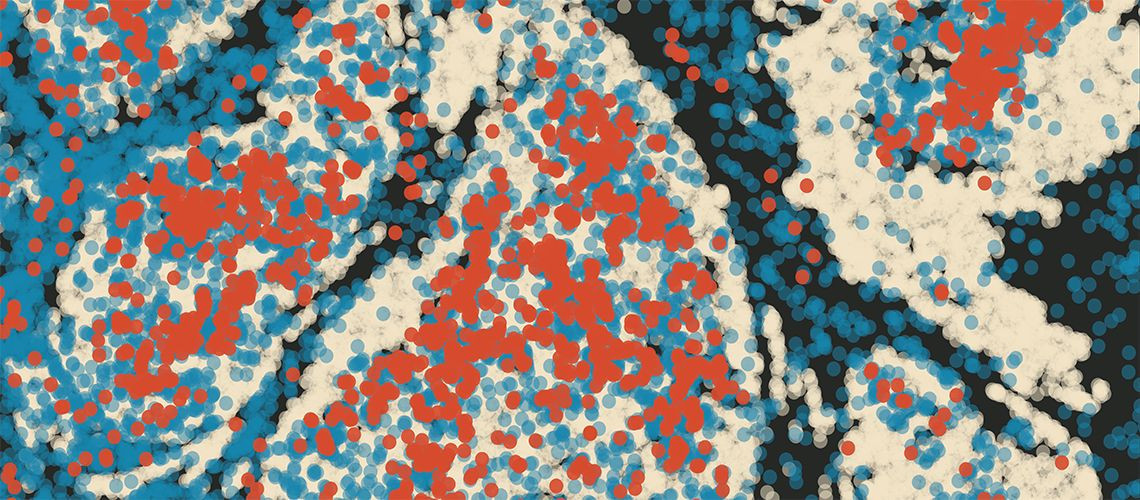 Πώς ο καρκίνος «χακάρει» το ανοσοποιητικό σύστημα: Η κρίσιμη ανακάλυψη για το μόριο CCL3