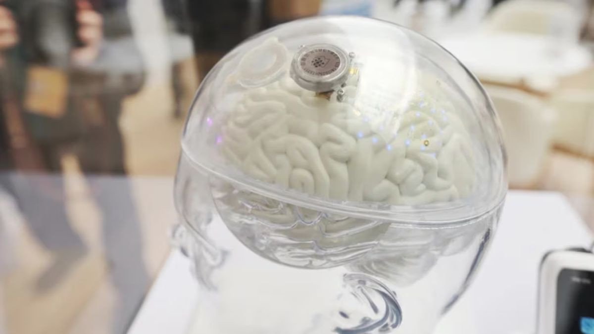 Κίνα: Εγκρίθηκε επίσημα το πρώτο στον κόσμο εγκεφαλικό εμφύτευμα για παράλυση!