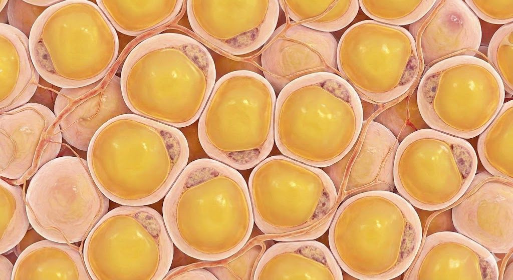 Παχυσαρκία: Εντοπίστηκε ο επιγενετικός «διακόπτης» που μπλοκάρει τα λιποκύτταρα