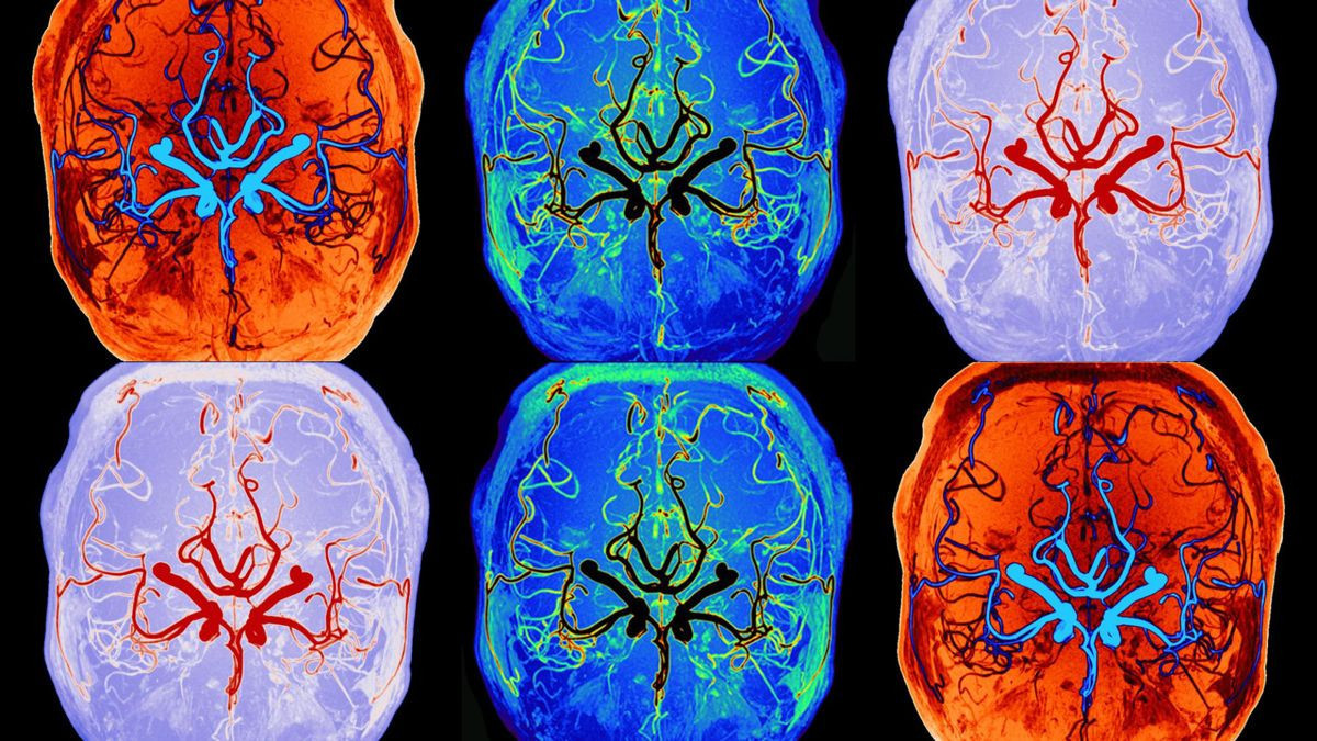 Καταγράφηκε ο μηχανισμός καθαρισμού του εγκεφάλου κατά τον ύπνο σε πραγματικό χρόνο!