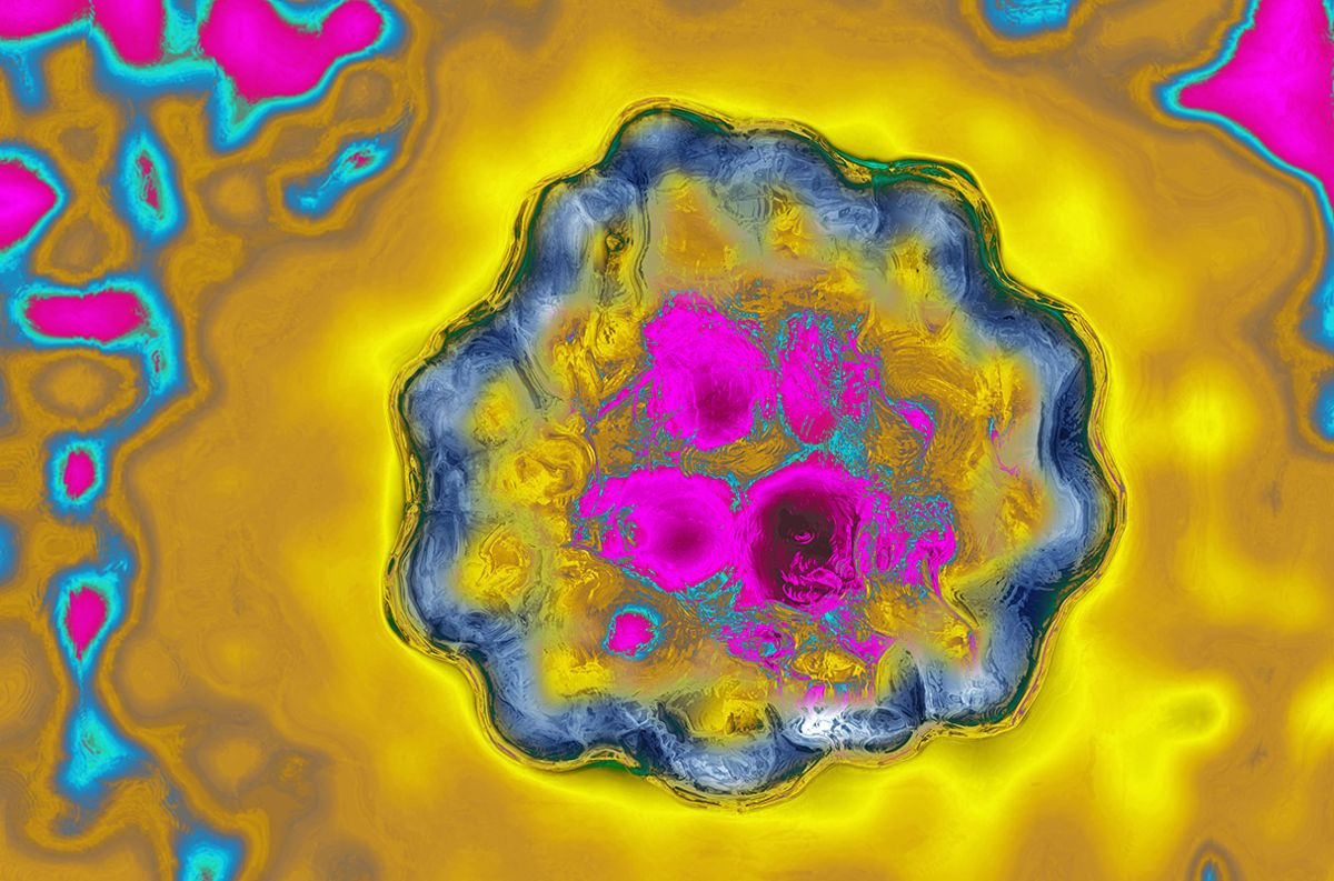 Ορόσημο στη Βιοπληροφορική: Για πρώτη φορά φορτώθηκε πλήρες γονιδίωμα σε κβαντικό υπολογιστή!