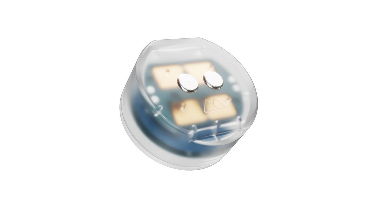 Εγκρίθηκε εμφύτευμα εγκεφάλου για την αντιμετώπιση της κατάθλιψης