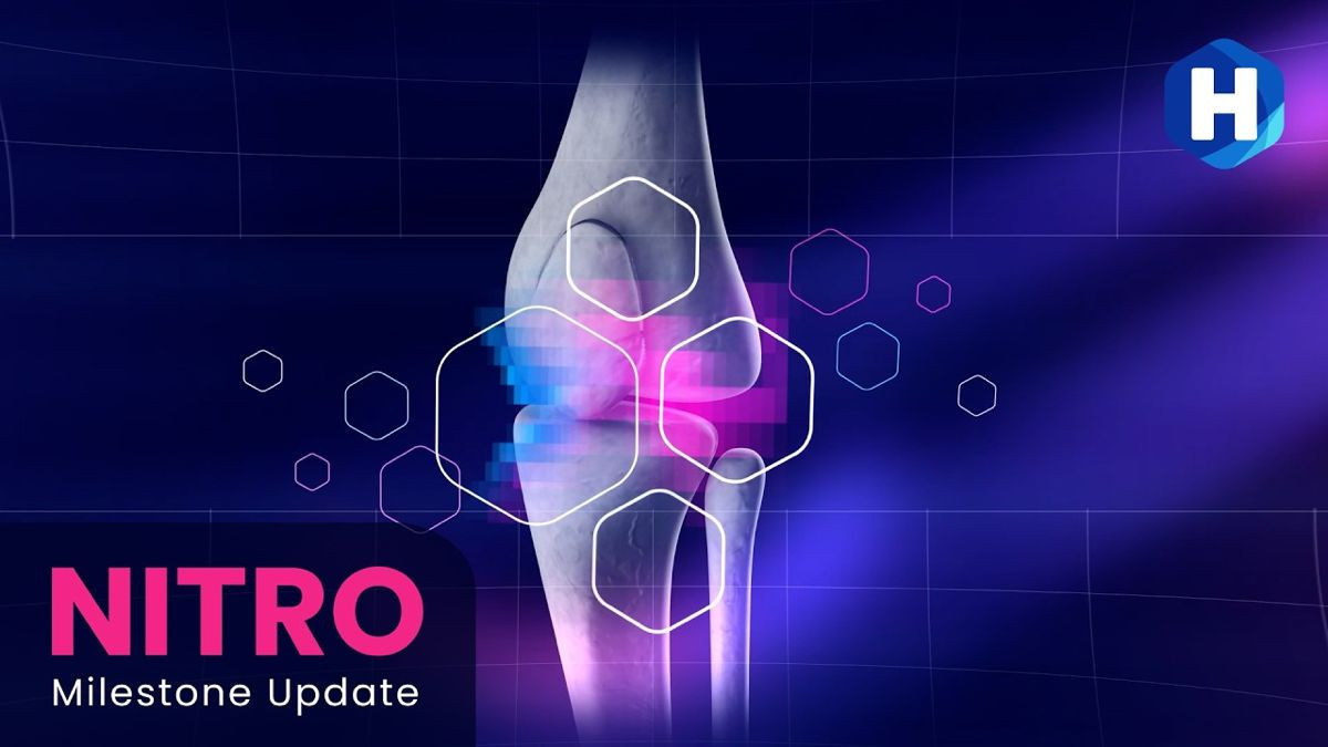 Η τεχνολογία που καταργεί τις αρθροπλαστικές: Ενθαρρυντικά δεδομένα για τη θεραπεία της οστεοαρθρίτιδας