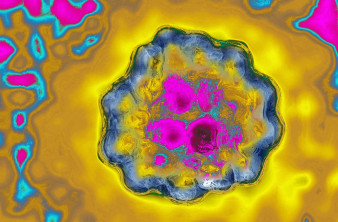 Ορόσημο στη Βιοπληροφορική: Για πρώτη φορά φορτώθηκε πλήρες γονιδίωμα σε κβαντικό υπολογιστή!