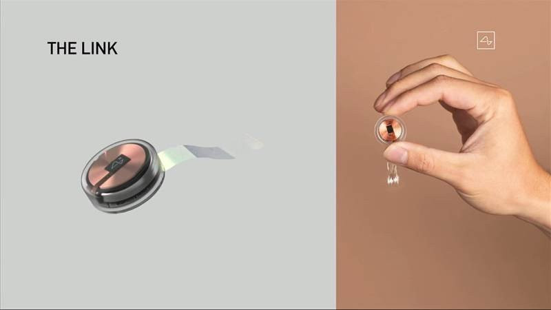 Neuralink: Ο Elon Musk ετοιμάζει τη νέα εποχή με το εμφύτευμα για τον εγκέφαλο |  Neuralink: Ο Elon Musk ετοιμάζει τη νέα εποχή με το εμφύτευμα για τον εγκέφαλο |