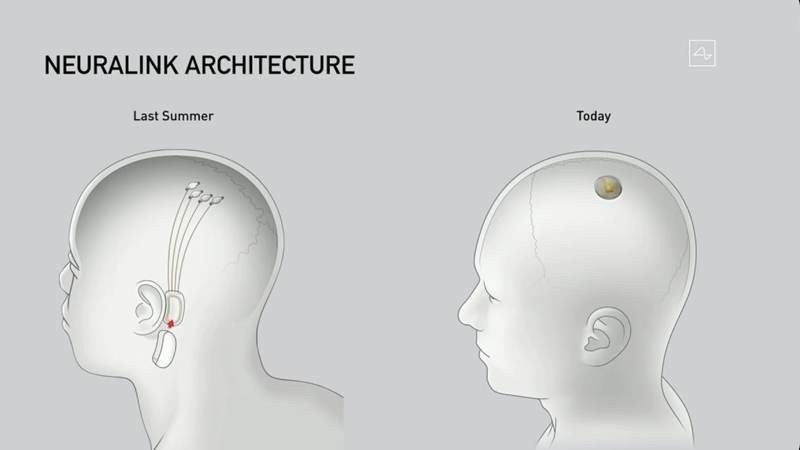 Neuralink: Ο Elon Musk ετοιμάζει τη νέα εποχή με το εμφύτευμα για τον εγκέφαλο |  Neuralink: Ο Elon Musk ετοιμάζει τη νέα εποχή με το εμφύτευμα για τον εγκέφαλο |